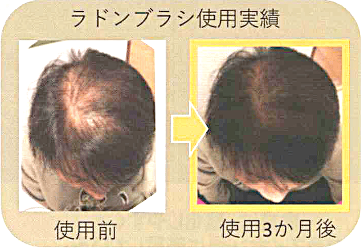 スタイリングブラシ+シャンプーブラシ最強2点セット:ラドンガス(マイナスイオン)発生【男女兼用】